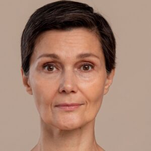 Before - Botox injections